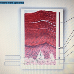 Art-labeling activity: thick and thin skin